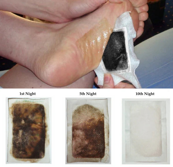 Nuubu - Detox Foot Pads